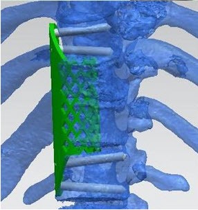 3d-vertebra-2